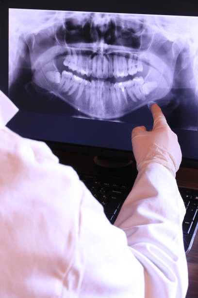 Best Emergency Dentist for Lost Fillings or Crowns in Jericho, NY