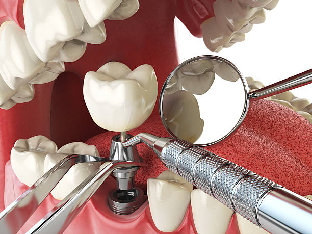 Best Emergency Dental Services for Seniors in Jericho, NY